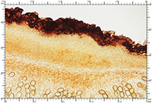 Genea hispidula